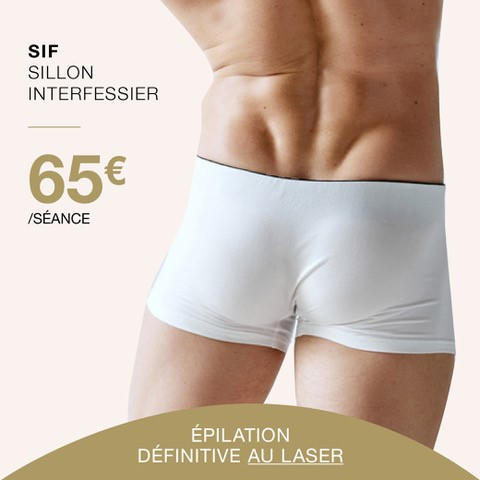 centre-epilation-laser-sif-homme-wemmel