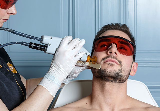 epilia epilation laser pour tous Epilia
