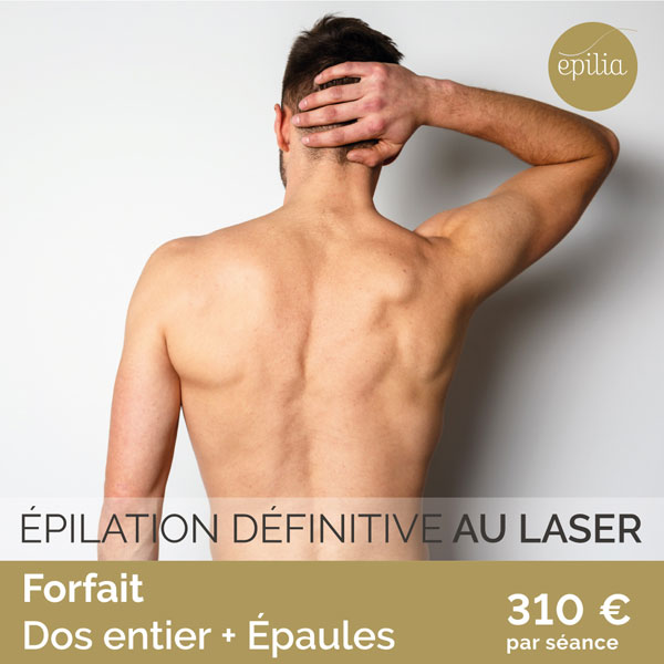 epilation-definitife-laser-forfait-homme-02