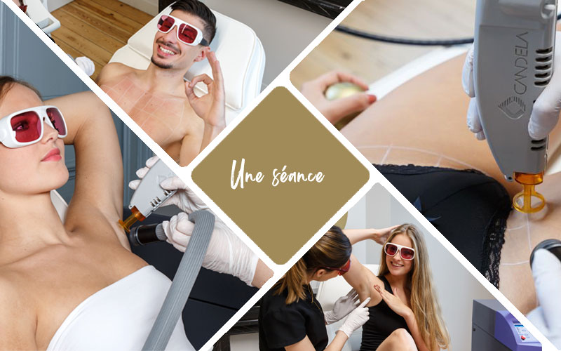 deroulement-seacnce-epilation-laser-cover