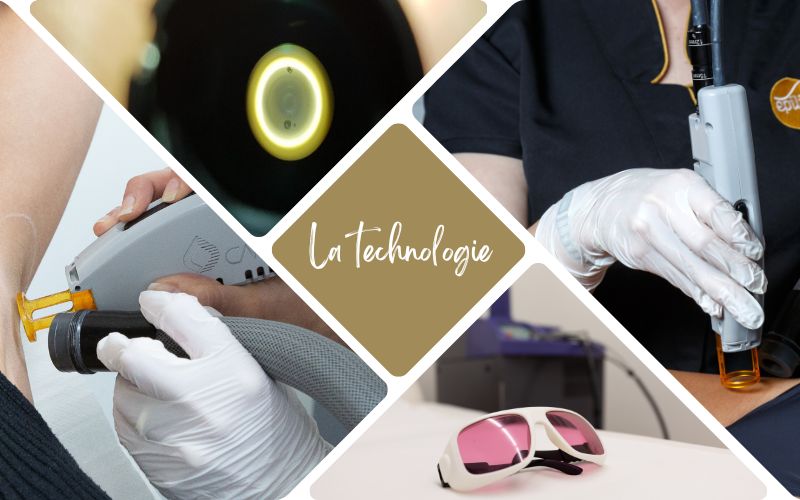 technologie-laser-comment-ca-fonctionne