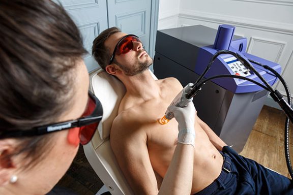 fonctionnement-epilation-laser-alexandrite